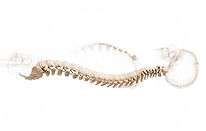 Best spine doctor in Atlanta - Dr. Vasudevan