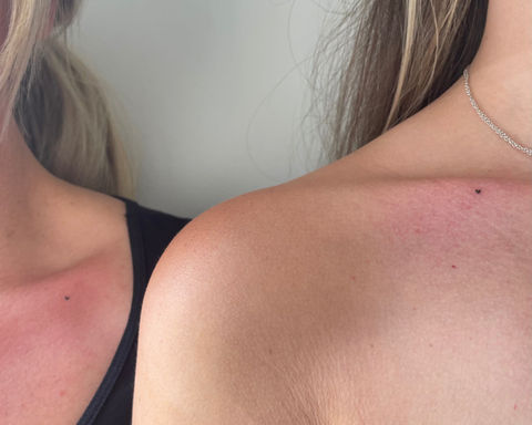 freckle tattoo on shoulder for women
