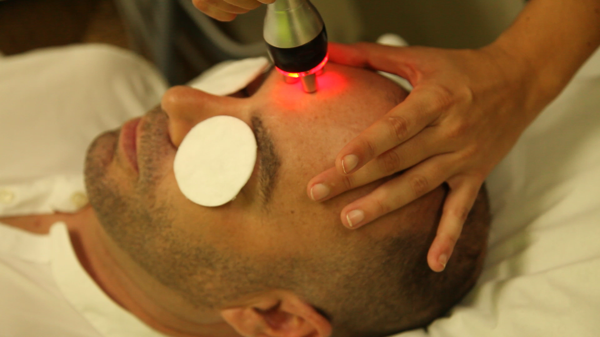 Radiofrecuencia facial masculina