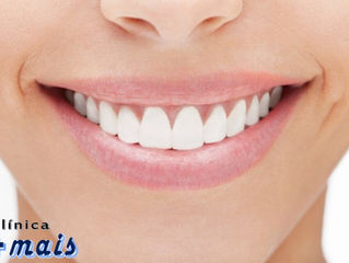 Veja 6 curiosidades que envolvem o seu sorriso. Fonte: Sorrisologia