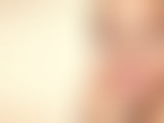 Você sabe o que é lente de contato dental?