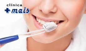 Saiba como evitar as manchas nos dentes. Fonte: Minha Vida