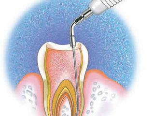 O que é endodontia?