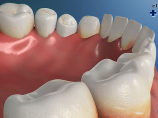 A função de cada tipo de dente. Fonte: Toda Biologia