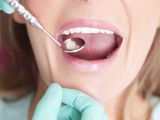 Descoberta científica pode acabar com os dentes chumbados. Fonte: Notícias ao Minuto