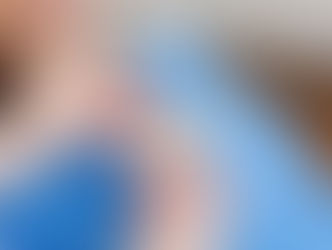 A prótese dentária precisa ser trocada com o tempo? Fonte: Sorrisologia