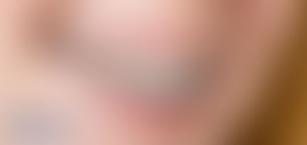 6 fatos que você vai descobrir quando tirar o aparelho. Fonte: Colgate