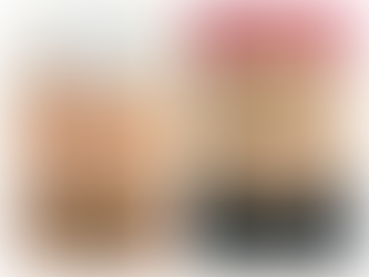 RF Skin Tightening vs Fat Cavitation | The Ultimate Non-Surgical Duo for Body Contouring in Newcastle