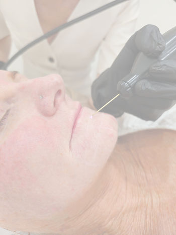 Fibroblast newcastle