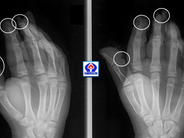 Ամանորի գիշերը «Սուրբ Աստվածամայր» ԲԿ են տեղափոխվել չորս երեխա