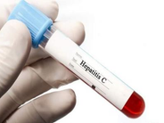 Հեպատիտ «Ց»-ի բուժման պետական ծրագիրն արդյունավետ գործում է. ԱՆ