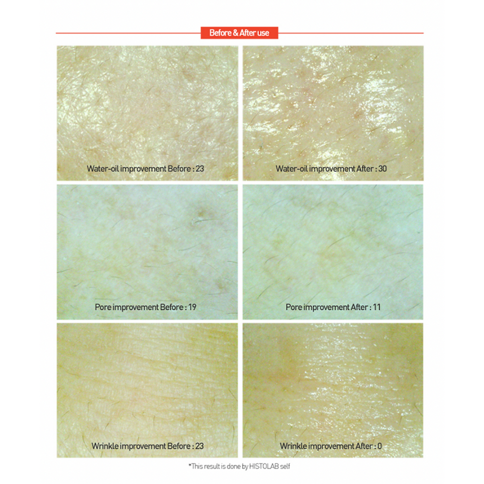 Thumbnail: Centella Red Cream