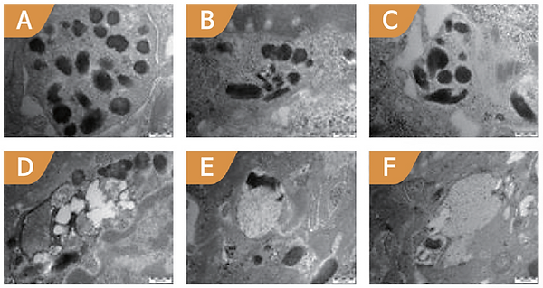 Laser Toning