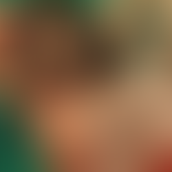 Limérence et amour sain en thérapie