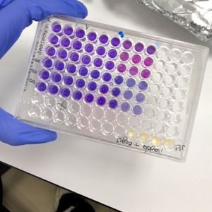 Betul aldemir dikici
izmir yuksek teknoloji enstitusu
biyomuhendislik bolumu
baldemir lab
biyomalzemeler ve doku muhendisligi