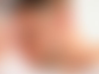 Enxaqueca pode aumentar o risco de problemas cardiovasculares