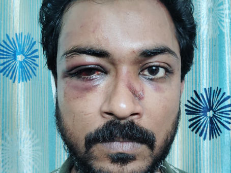 होली के दिन लखनऊ में खूनी संघर्ष, लोहे की रॉड-सरिया से हमला; कई घायल