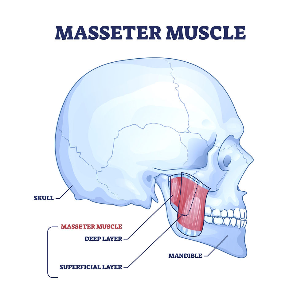 This is a graphic designed image showing a skull and the massester muscle. The massester muscle cause TMJ pain, jaw pain, and even referred teeth pain.