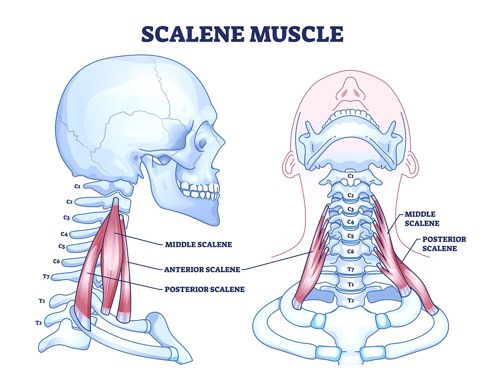 This graphic designed image shows the scalene muscles inserting onto the cervical vertebrae and the 1st and 2nd rib. These muscles cause TMJ pain, Jaw pain, neck pain, rib pain, and more.