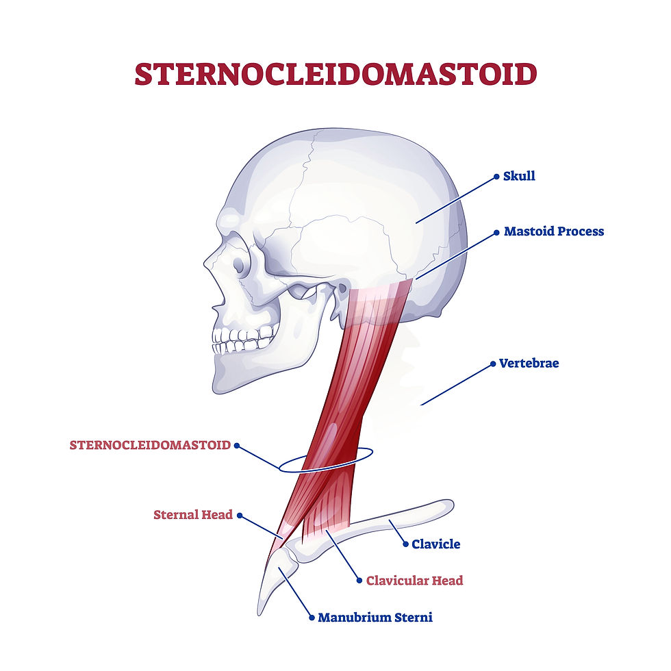 This graphic designed image shows the SCM, the sternocleidomastoid muscles. These muscles cause TMJ pain, Jaw pain, neck pain, rib pain, and much more.