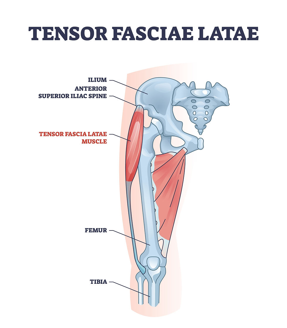 A graphic designed image of the tensor fasciae latae muscle, TFL for short. 