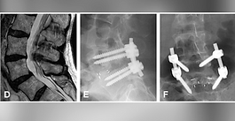 LESS Society Journal Club # 01