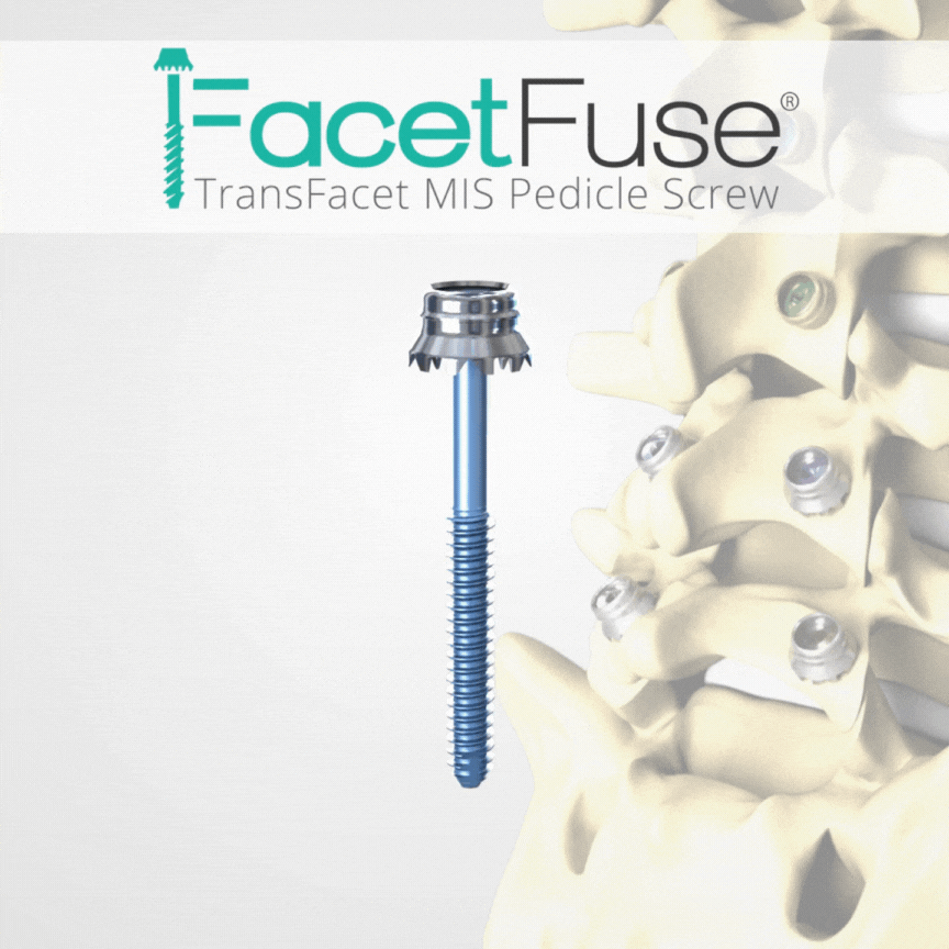 Facet Fuse Gif (1).gif