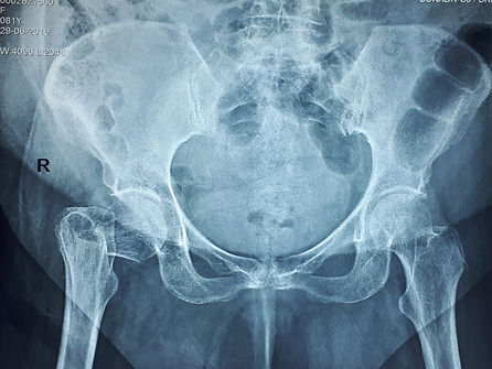 IMAGING DIAGNOSTICS - XRAY