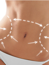 liposculpture.png