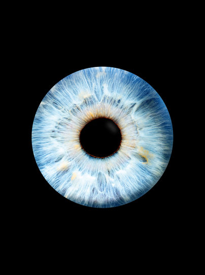 Irisfotografie Steyr Rußkäfer