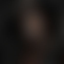 Kapşonlu, yara izleriyle kaplı bir yüz. Gri ve siyah tonlarında, karanlık ve dramatik bir ortamda duruyor. Korkutucu bir hava.