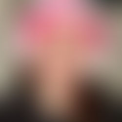 Woman wearing a white LED hair regrowth helmet emitting red light, labeled "CURRENTBODY Skin." Neutral expression, indoor setting.