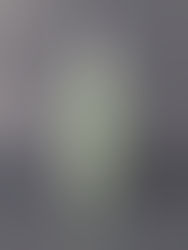 A green bottle of Phyto Fresh Scalp Scaler by Dr.FORHAIR on a gray backdrop. White gel squiggle on a transparent card in front.