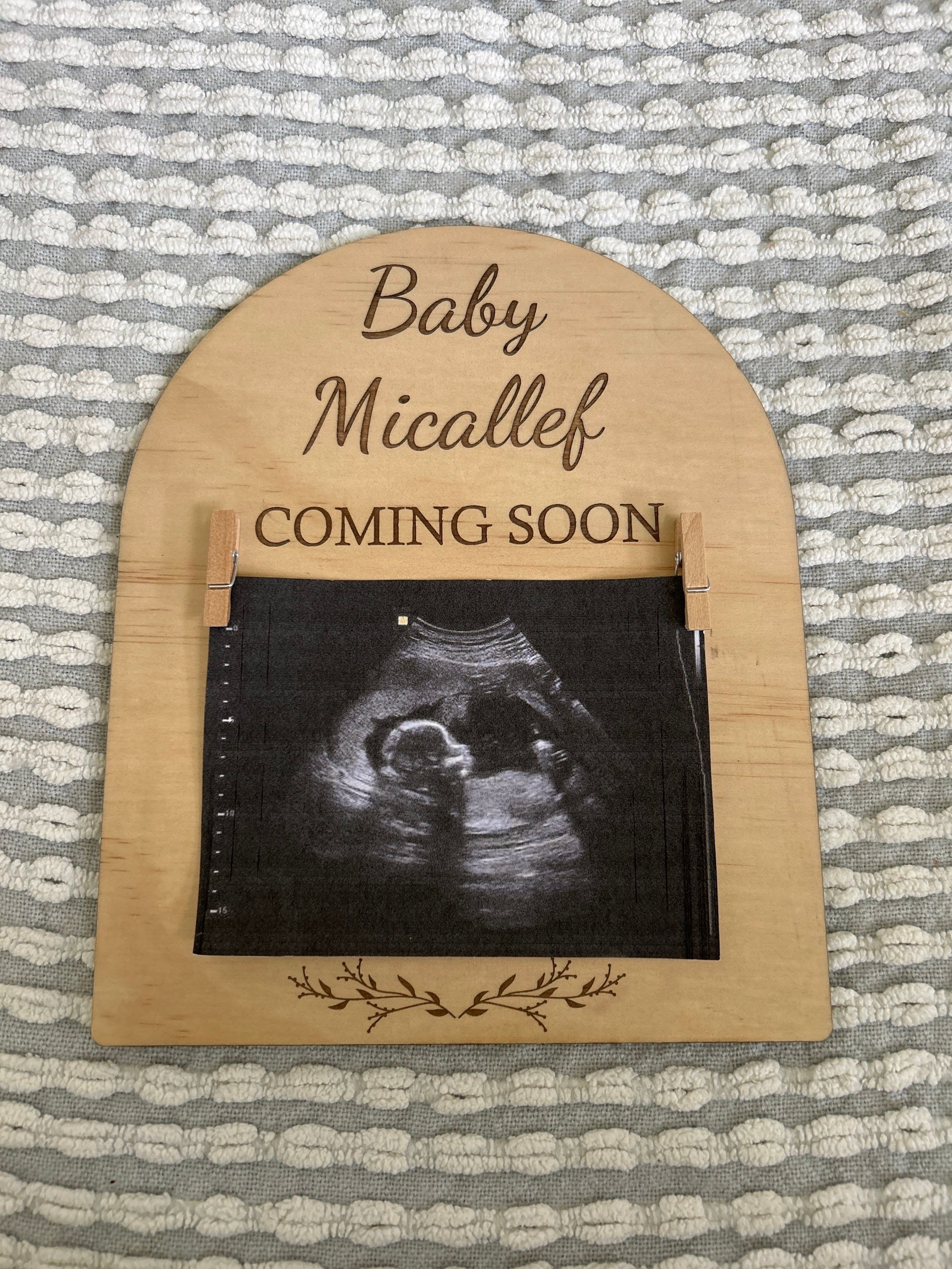 Ultrasound Peg Board