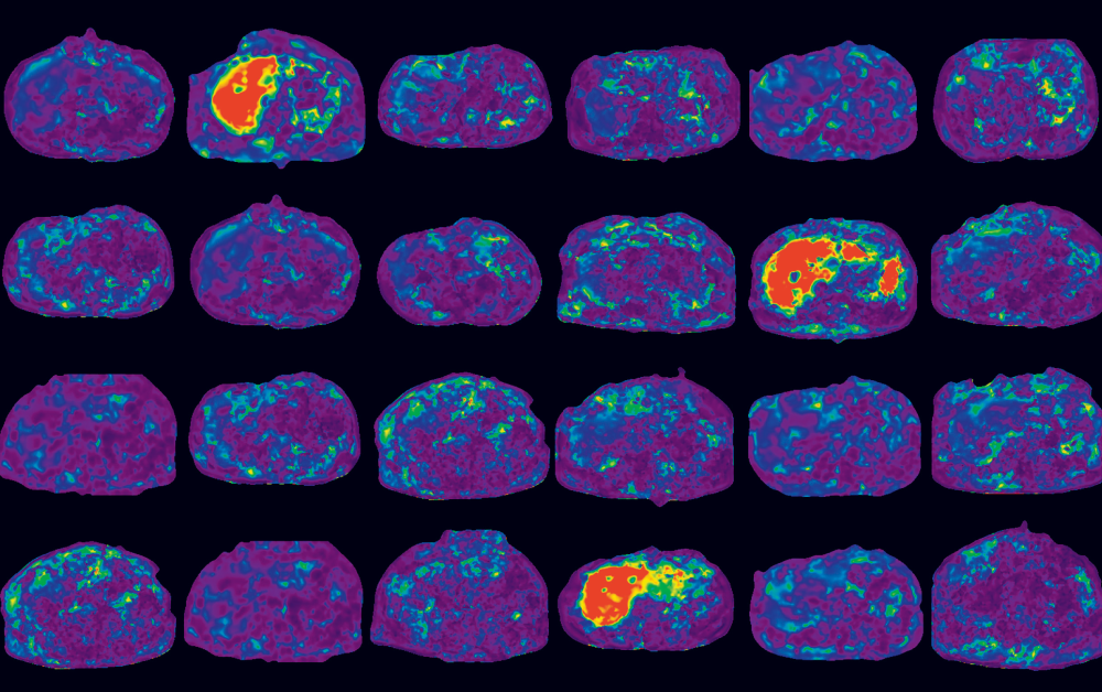 MR Elastography United States Resoundant, Inc.