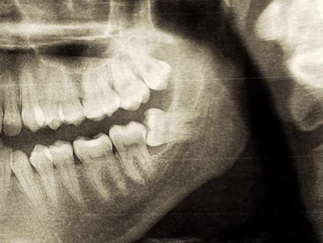 DEAD HEROES Set Strong Alt Rock Foundations With Debut Single "Witch Doctor"