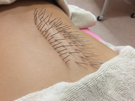 私の治療の根本