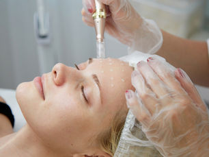 Unlock Radiant Skin with Microneedling  