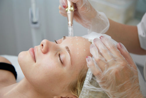 Unlock Radiant Skin with Microneedling  