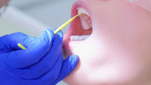 Fluoride: Nature’s Cavity Fighter