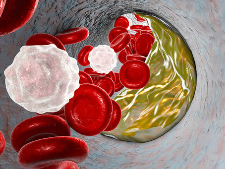 Καλή και κακή χοληστερόλη: Πώς επηρεάζουν τη γονιμότητα