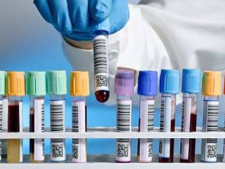 ΕΟΠΥΥ: Σε αναζήτηση 50 εκατ. ευρώ για μείωση του clawback στους παρόχους