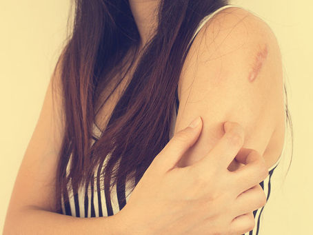 Δερματικά εξανθήματα: Αναγνωρίστε τα μέσα από φωτογραφίες