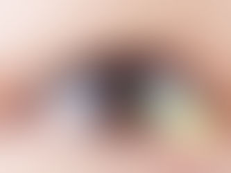 Επέμβαση καταρράκτη: Δείτε πόσο μειώνει τον κίνδυνο ατυχημάτων