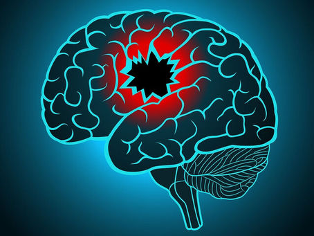 Αγγειακά Εγκεφαλικά Επεισόδια: Απλές απαντήσεις σε 5 σημαντικά ερωτήματα