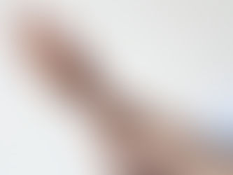 Ρευματοειδής αρθρίτιδα: 10 πρώιμα συμπτώματα
