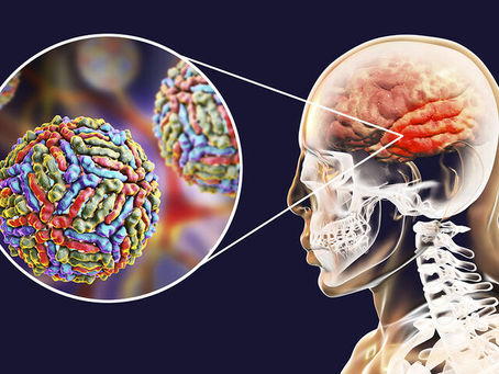 Εγκεφαλίτιδα: 6 ενδείξεις σε εικόνες