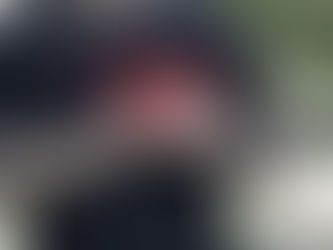 Πρόβλημα στις αρτηρίες: Αυτά είναι τα βασικά συμπτώματα που πρέπει να γνωρίζετε