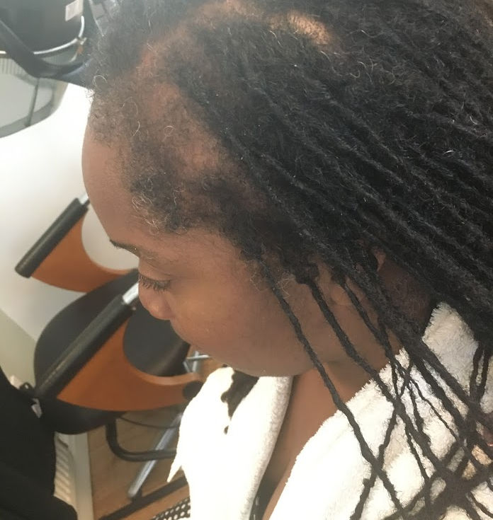 Understanding Hair Loss and Growth: Causes, Facts, and Ways to Promote Healthy Hair