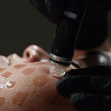 HydraFacial treatment